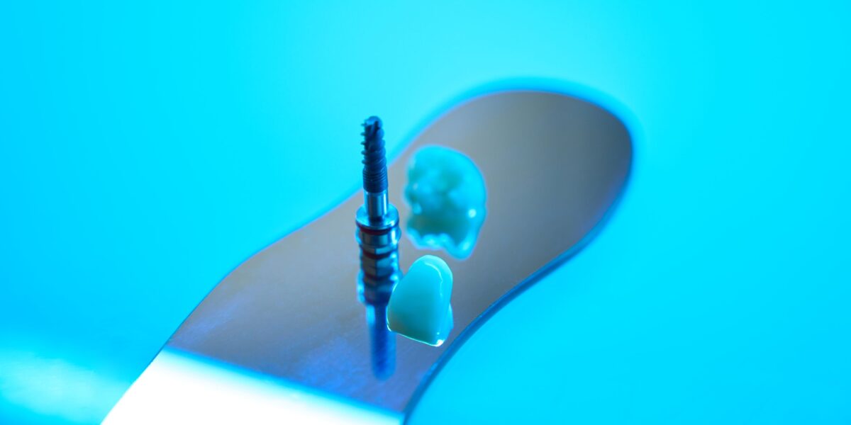 que necesito para poder tener mini implantes dentales en houston