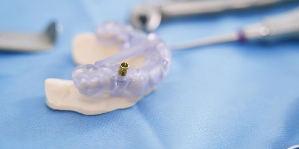 placa dental con mini implantes houston, texas
