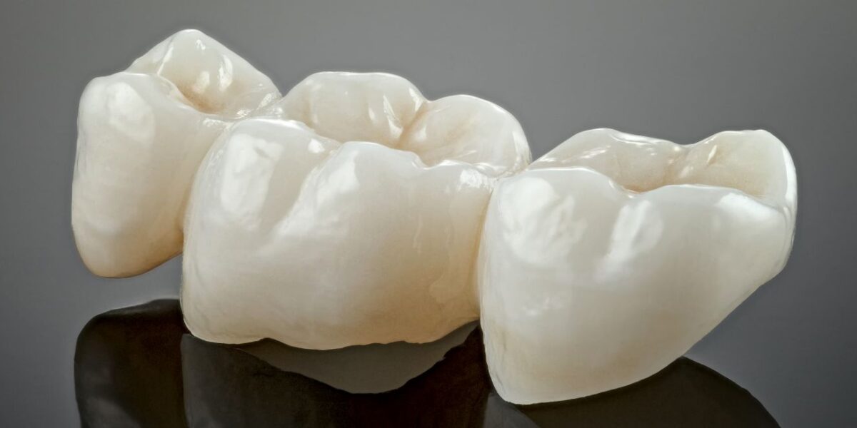 coronas dentales en houston, texas dentistas hispanos